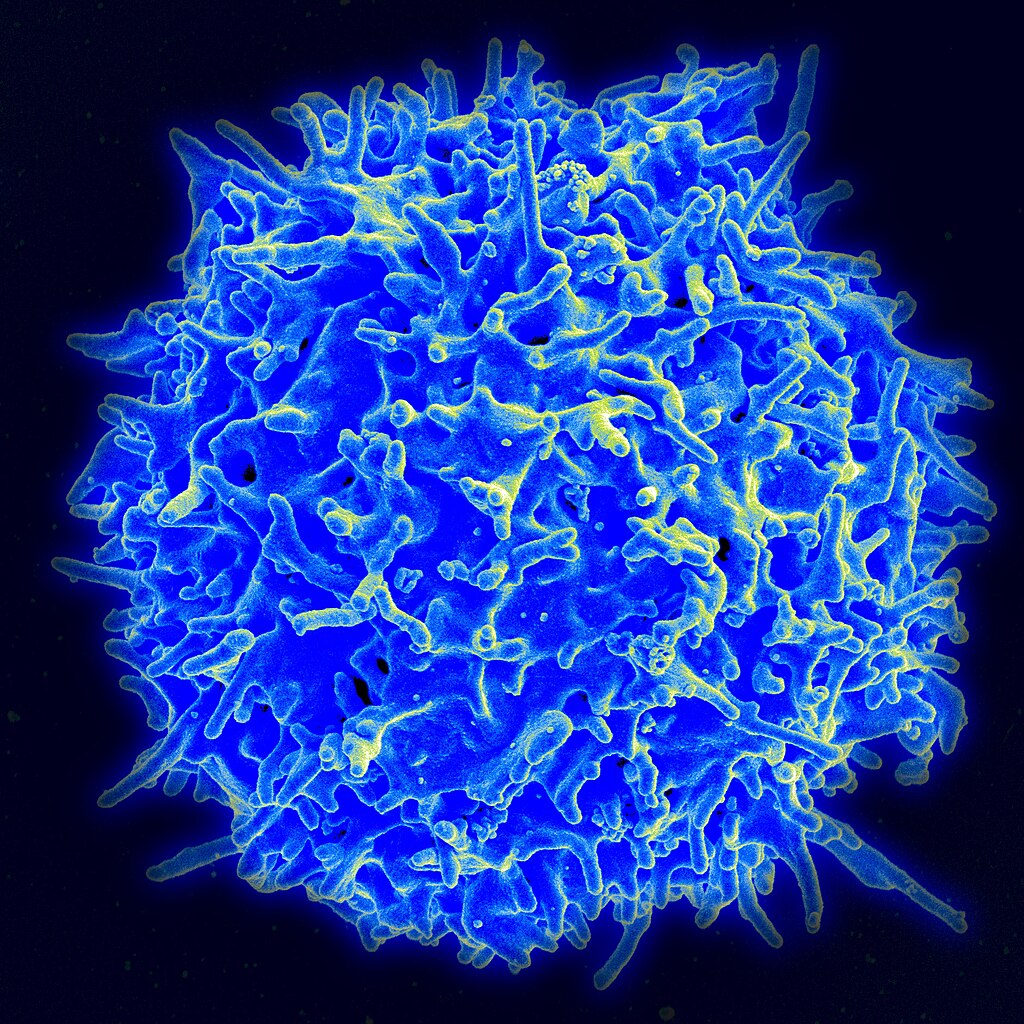 Colorized scanning electron micrograph of a T lymphocyte