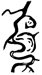 meandering can lead to
orphaned loops